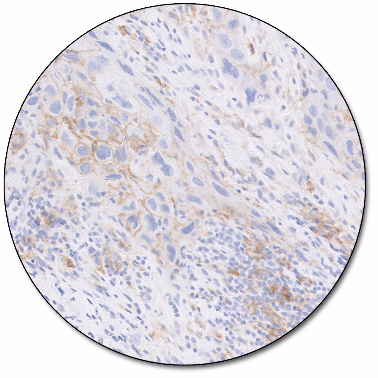 PD-L1 IHC 22C3 pharmDx for Autostainer Link 48